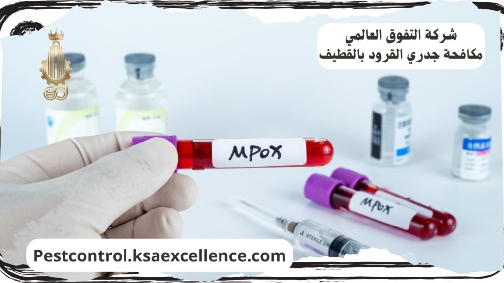 مكافحة جدري القرود بالقطيف