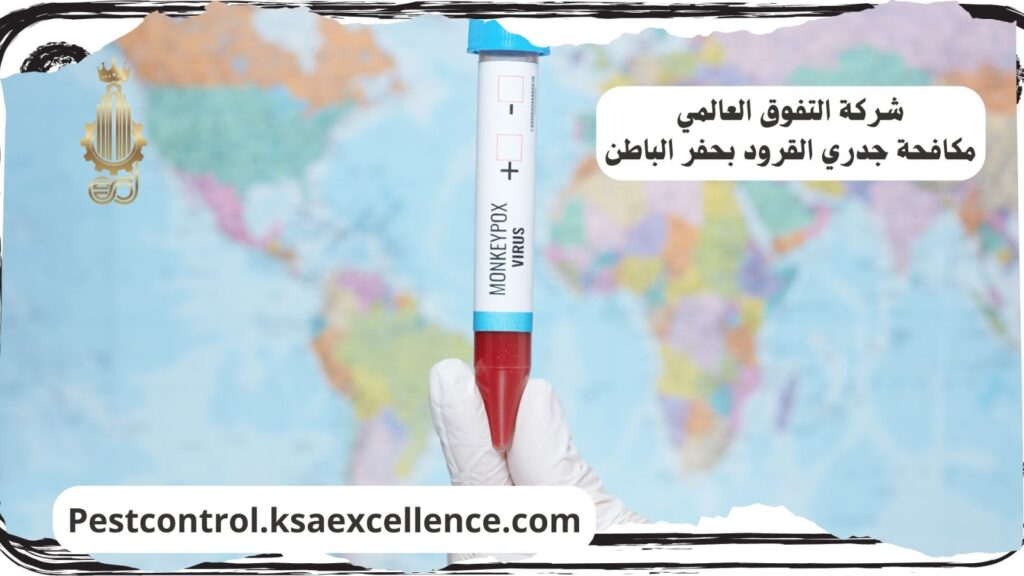 مكافحة جدري القرود بحفر الباطن