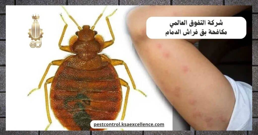 شركة مكافحة بق فراش بالدمام